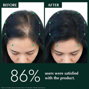 Foliluxe™ Fortify Hair Oil - RO|OT
