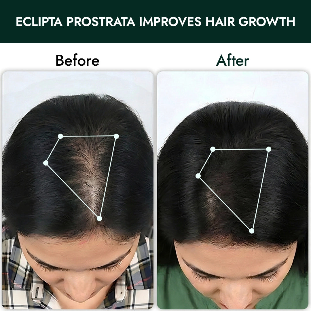 Foliluxe™ Hair Ritual Duo