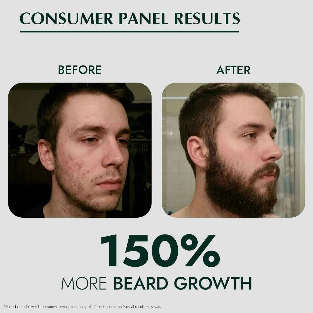 Foliluxe™ Crown Beard Oil - RO|OT