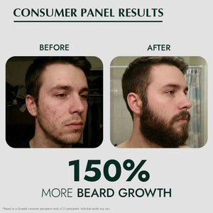 Foliluxe™ Crown Beard Oil - RO|OT